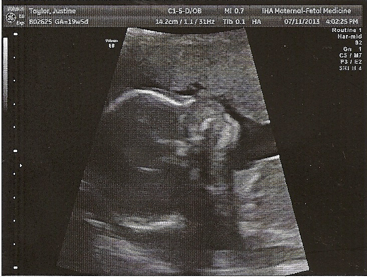  photo 19andahalfweeks_zpsa6bb7f33.jpg