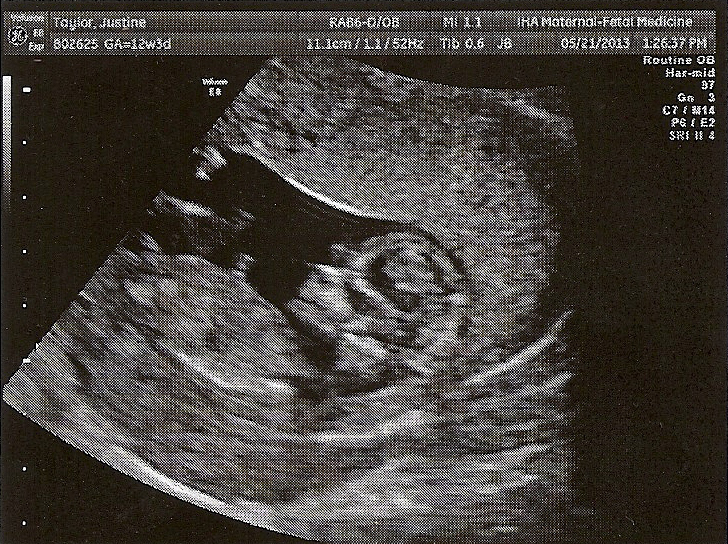  photo twelveandahalfweeks_zps16badb01.jpg