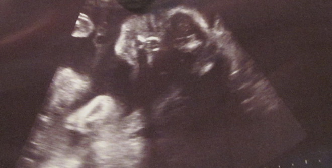  photo Baby24weeks_zps76167d1b.jpg