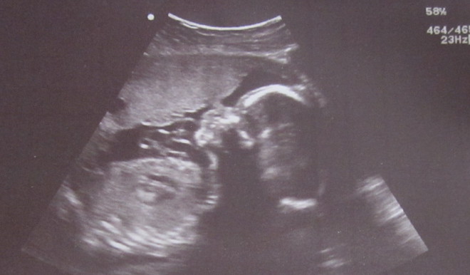  photo Baby322weeks_zps7e2d0d2a.jpg