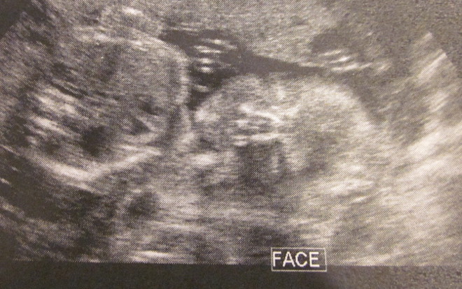  photo IMG_8454_zpscbc950cf.jpg