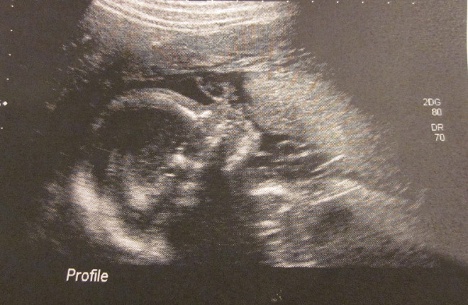  photo IMG_8456_zps9f1c6d28.jpg