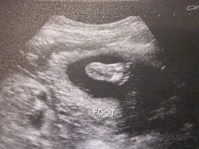  photo 245_zps0e784c0a.jpg